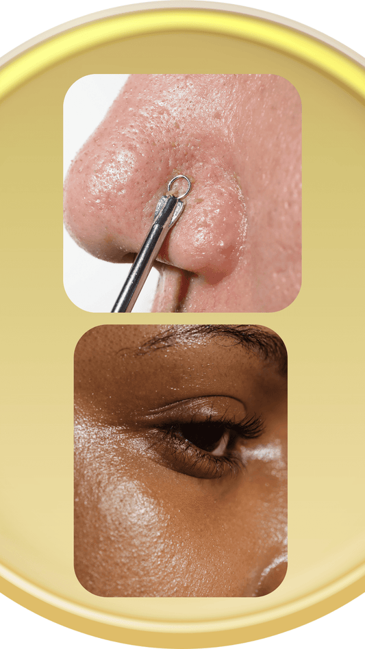 Close-up of a tool clearing clogged pores and a model with clear skin, emphasizing clogged pores skincare tips.