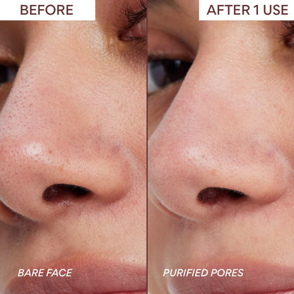 innisfree – Super-Vulkan-Porentonmaske