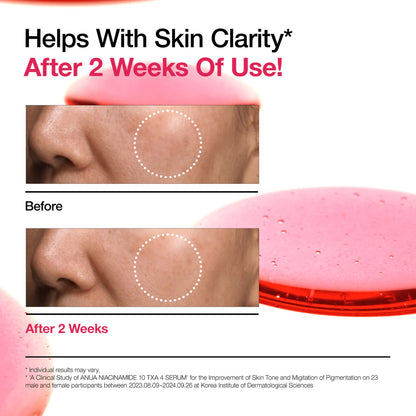 ANUA Niacinamide 10+TXA 4 Serum for dark spots